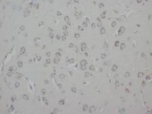 Neuromodulin GAP43 Rabbit Polyclonal Antibody