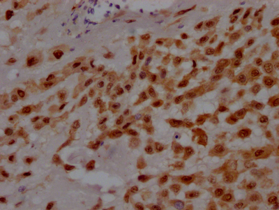 GATA3 Antibody