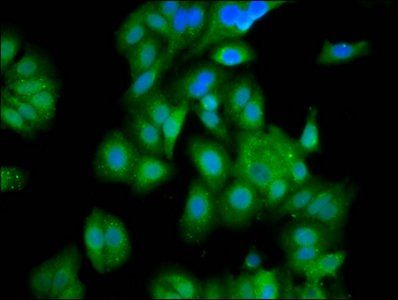 GATB Antibody
