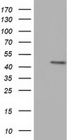 GBE1 Antibody