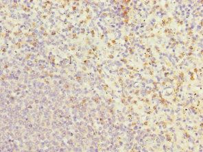 GCA Antibody