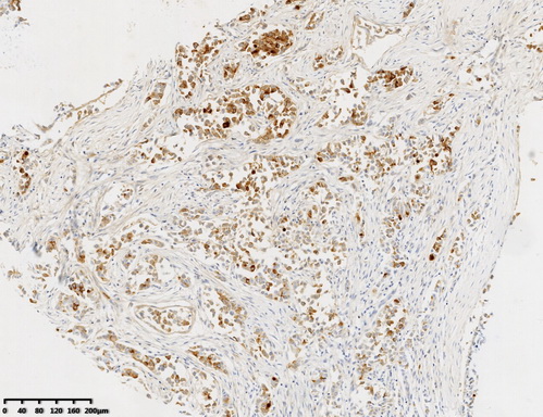 GCDFP 15 Antibody