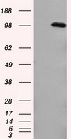 GCDFP 15 Antibody