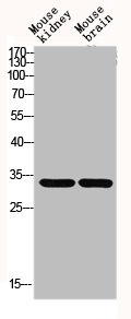 GCLM Antibody