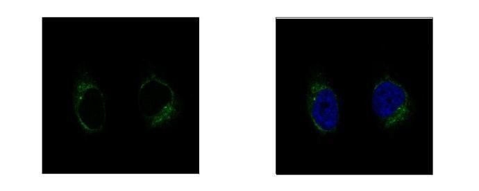 tubulin gamma complex associated protein 2 Antibody