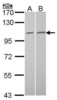 tubulin gamma complex associated protein 2 Antibody