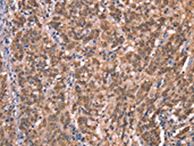 GCSAM Antibody