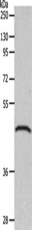 GDF1 Antibody