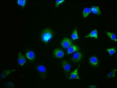GDF5 Antibody