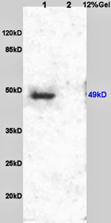 GDF9 Rabbit Polyclonal Antibody