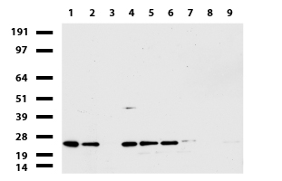 GDI1 Antibody