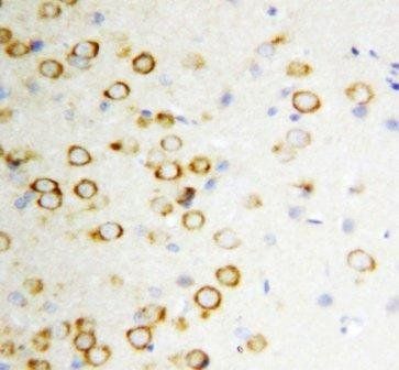 GDNF Rabbit Polyclonal Antibody