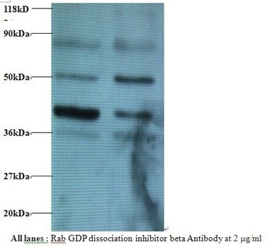 GDI2 Antibody