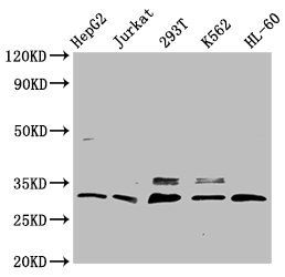 GEMIN2 Antibody