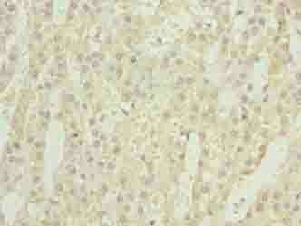 GEMIN6 Antibody