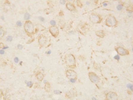 GFAP Rabbit Polyclonal Antibody