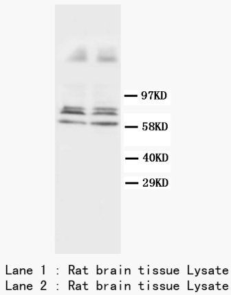 GFAP Rabbit Polyclonal Antibody
