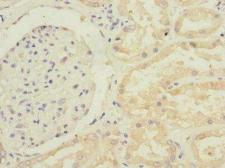GFM2 Antibody
