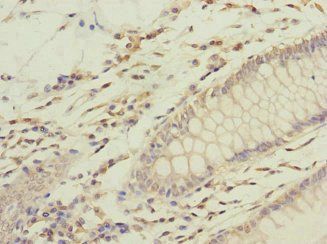GFM2 Antibody