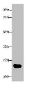 GGTLC2 Antibody