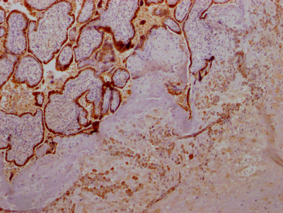 GH1 Antibody