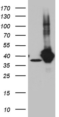GIPC1 Antibody