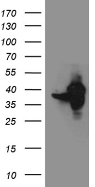 GIPC1 Antibody