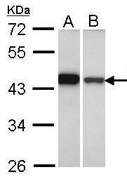 GIPC1 antibody