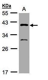 GIPC3 antibody [N1], N-term