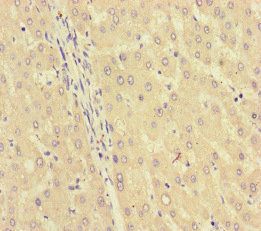 GK Antibody