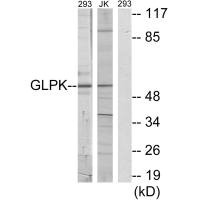 GK Antibody