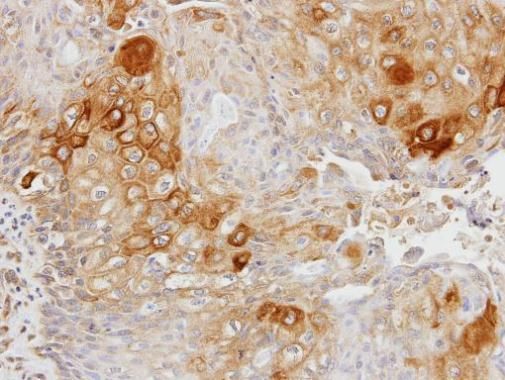 Glycerol kinase 2 antibody [N1C1]