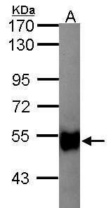 Glycerol kinase 2 antibody [N1C1]