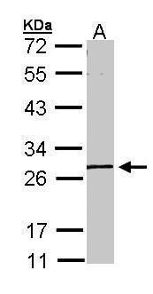 GK5 Rabbit Polyclonal Antibody