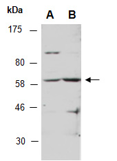 GLIS2 (C) Antibody, Rabbit Polyclonal