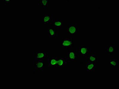 GLIS3 Antibody
