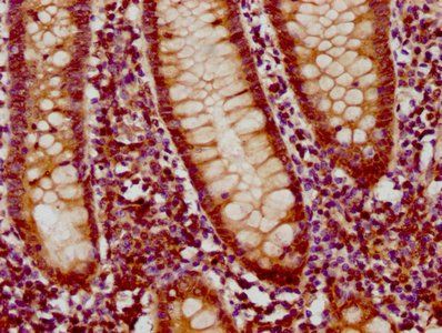 GLIS3 Antibody