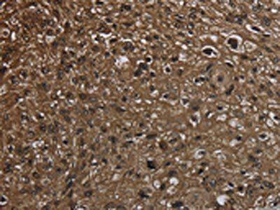GLO1 Antibody