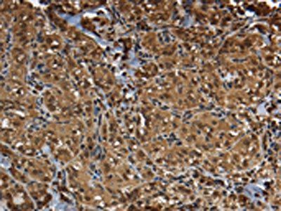 GLO1 Antibody
