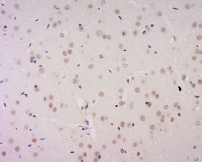 GLRB Rabbit Polyclonal Antibody