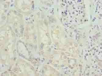 GLS Antibody