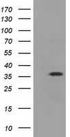 SLC2A5 Antibody