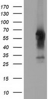 Glucose Transporter 5 GLUT5 Antibody
