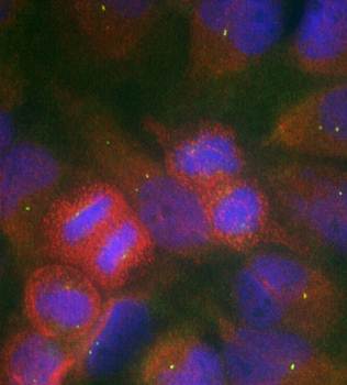 GluR1 (Ab-863) Antibody