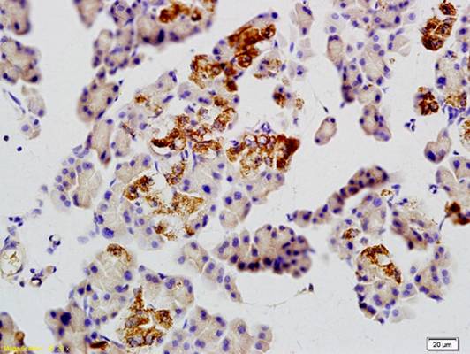 GLUT10 Rabbit Polyclonal Antibody