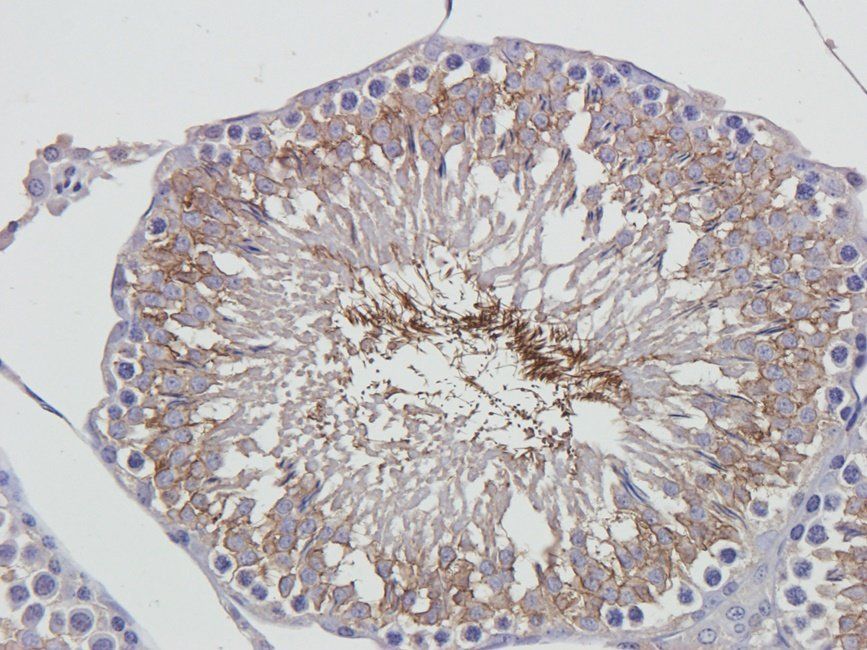 GLUT3 Rabbit Polyclonal Antibody