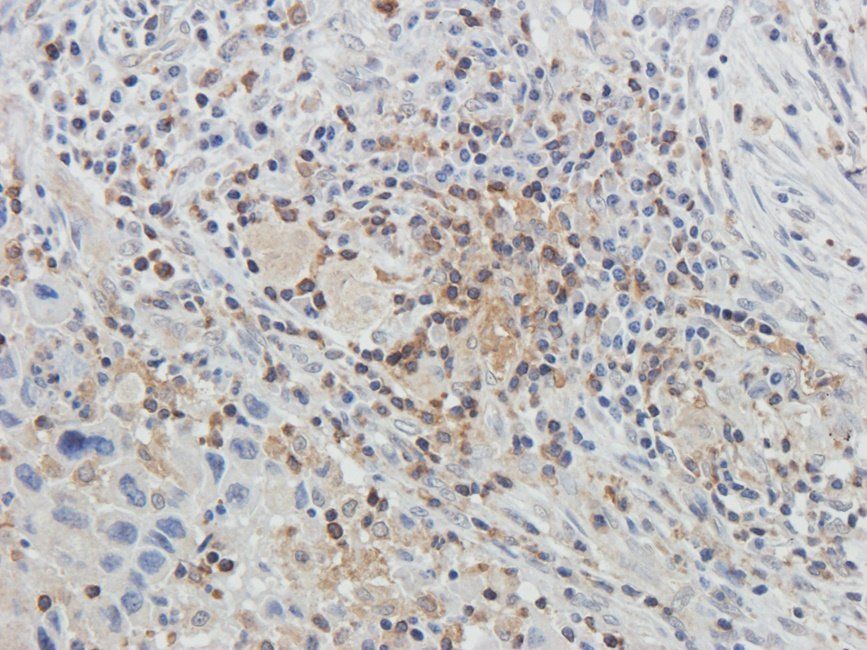 GLUT3 Rabbit Polyclonal Antibody