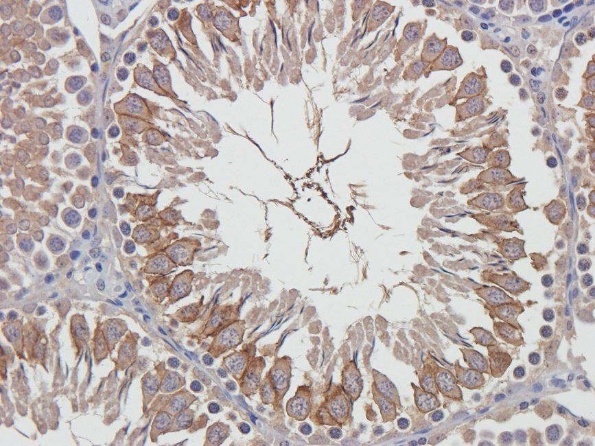 GLUT3 Rabbit Polyclonal Antibody