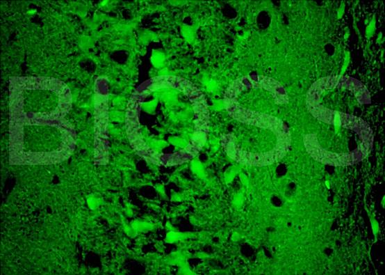 GLUT3 Rabbit Polyclonal Antibody (FITC)