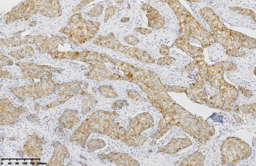 Glutamine Synthetase Antibody